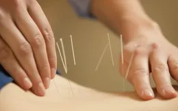 Hà Nội: Đình chỉ hoạt động cơ sở đông y không phép