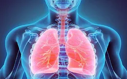 Viêm phổi ở bệnh nhân đái tháo đường