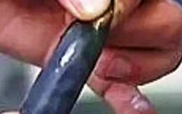 Suy thận do ăn mật cá trắm