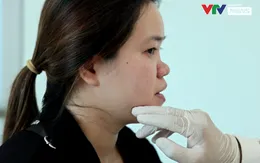 Cô gái mất sống mũi do bị nhét nhụy hoa vào mũi gây nhiễm trùng