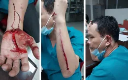 Bình Phước: Điều dưỡng viên bị người nhà bệnh nhân hành hung dã man