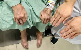 Cảnh báo tình trạng gout nặng do lạm dụng bia, rượu