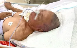 Phục hồi chức năng cho bệnh nhân xuất huyết não
