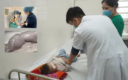 Thời tiết thay đổi, gia tăng tình trạng trẻ mắc bệnh lồng ruột