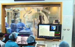 Can thiệp mạch vành nhờ robot