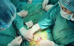 Cứu bé sơ sinh trải qua 4 lần đại phẫu trong 20 ngày đầu đời