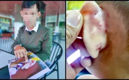 Nhiều trẻ em bị bạo hành, xâm hại được các cơ sở khám chữa bệnh phát hiện