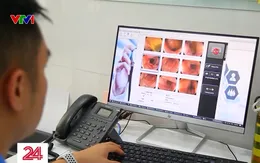 Ứng dụng AI trong nội soi tiêu hóa và chẩn đoán ung thư sớm