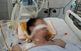 Cứu sống bệnh nhân viêm màng não trên nền bệnh Lupus ban đỏ hệ thống
