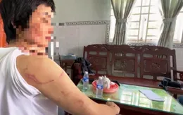 Mang thai tháng thứ 7 vẫn bị chồng bạo hành không thương tiếc