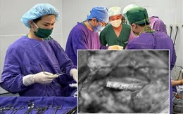 Ghép mạch tự thân cứu bệnh nhân mất đoạn mạch vùng cổ thoát chết kỳ diệu
