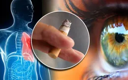 Mít tinh hưởng ứng Ngày Thế giới không thuốc lá 31/5 và Tuần lễ Quốc gia không thuốc lá
