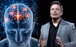Triển vọng thử nghiệm cấy chip của công ty Neuralink