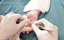 3 trẻ bị bỏng nặng do máy chạy bộ - Khuyến cáo an toàn cha mẹ nên lưu ý