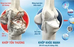 Huacomplex - Giải pháp mới bổ sung dịch nhờn bôi trơn khớp