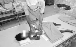 Bé gái nhập viện vì đau bụng, bác sĩ lấy ra một búi tóc trong ruột non