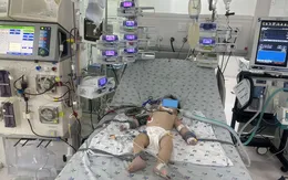 Thêm nhiều trường hợp trẻ bệnh tay chân miệng nặng nhập viện