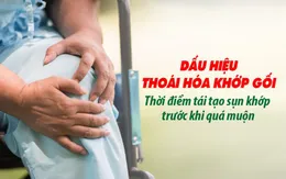 Dấu hiệu thoái hóa khớp gối - Thời điểm tái tạo sụn khớp trước khi quá muộn
