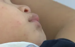 Cần chủ động phòng ngừa khi bệnh tay chân miệng có chiều hướng gia tăng