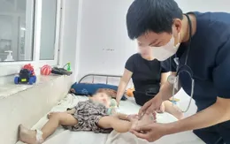 Đắk Lắk: Gia tăng tình trạng trẻ mắc tay chân miệng thể nặng