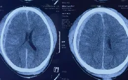 Cảnh báo một ca tử vong do không đảm bảo an toàn lao động