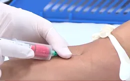 Dịch sốt xuất huyết diễn biến bất thường