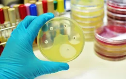 Viêm mũi xoang cấp do loại vi khuẩn siêu kháng kháng sinh gây ra
