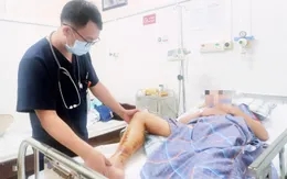 Cảnh báo tình trạng rắn cắn vào mùa hè