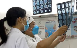 Bé 6 tuổi bị lệch não qua trái sau tai nạn giao thông