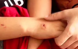 Người dân Đồng Nai tăng cường đi tiêm phòng dại