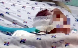 Bé trai 6 tháng tuổi bị bảo mẫu bạo hành đã qua đời