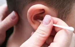 Cảnh báo nguy hiểm khi dùng dụng cụ ngoáy tai