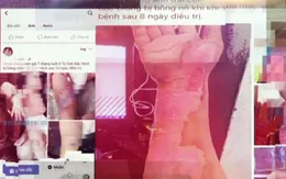Sự thật về người tự xưng "lương y" chữa bỏng