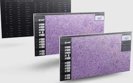 Bệnh nhân ung thư sẽ được  chẩn đoán sớm với mô hình AI thị giác