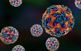 Sở Y tế TP. Hồ Chí Minh: Coxsackievirus A24 là tác nhân chính gây bùng phát bệnh đau mắt đỏ