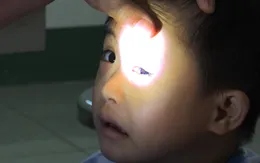 Cà Mau tăng cường phòng bệnh đau mắt đỏ