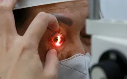 Nêu cao ý thức phòng bệnh và xử trí kịp thời khi đau mắt đỏ