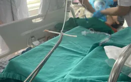 Người phụ nữ bị tăm bông mắc tại khí quản nguy kịch