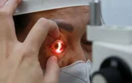 Gia tăng các ca bệnh đau mắt đỏ, nhiều trường hợp biến chứng nặng