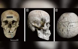 Bí ẩn về những hộp sọ Nhật Bản cổ đại bị “biến dạng”