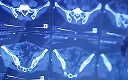 Thụt tháo đại tràng: Nguy hiểm vẫn được truyền bá có tác dụng thải độc