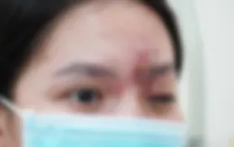 Nhiều người mất Tết vì biến chứng do làm đẹp
