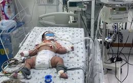 Cứu bé trai sốc sốt xuất huyết biến chứng suy hô hấp, tổn thương gan nặng
