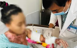 Nướng mực bằng cồn, 2 chị em bị bỏng nặng