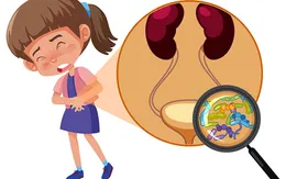 Đừng chủ quan với bệnh viêm đường tiết niệu