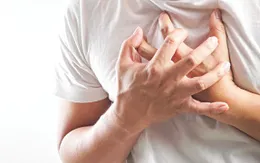 Người đàn ông ngừng tim do nhồi máu cơ tim cấp