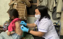 Nhiều học sinh tại Lào Cai mắc thủy đậu