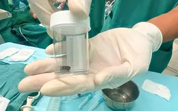 Phối hợp liên viện lấy cuống quả xoài trong phổi bé trai 8 tháng tuổi