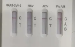 Nhiều trẻ trở nặng do nhiễm virus hợp bào hô hấp RSV