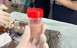 Bé 3 tháng tuổi bị áp xe phổi nguy hiểm tính mạng